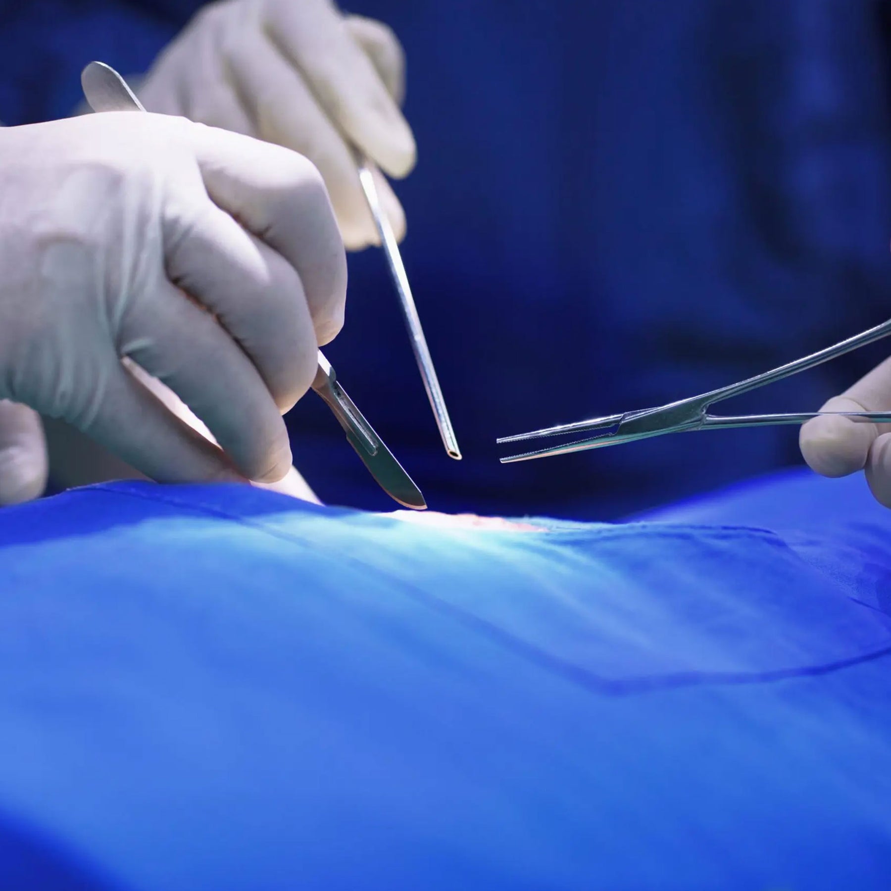 What to Know About Surgical Repairs