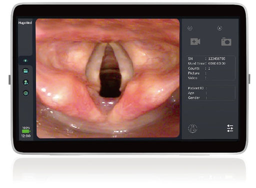 HugeMed MS-8 Video Laryngoscope, Titanium Blades - Didage